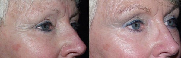 Software: Microsoft Office